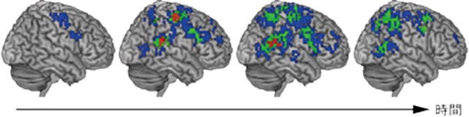 運動主体感に関連する脳活動が時間とともに変化する様子
